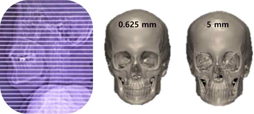 CBCT 영상 슬라이스 cut 기준 및 간격에 따른 모델 형상의 재현성