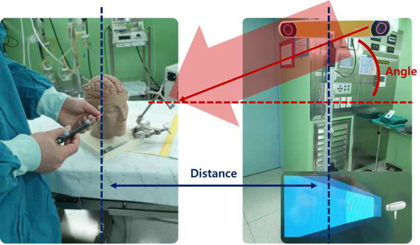 내비게이션 장비와 대상(환자)의 마커 간의 거리 및 각도 조절