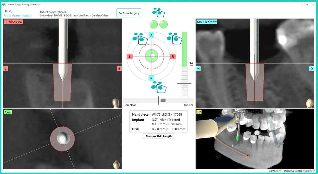 Dynamic Computer-assisted Surgery systems 방식을 적용한 상용 의료기기 (출처: Navigate Surgical Technologies Inc., Inliant® system)