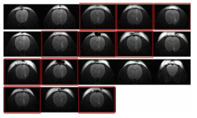 MRI 영상을 활용한 1차 동물선별 및 치료 3주일 후 FP-CIT PET 영상, 7일(B) 후 측정