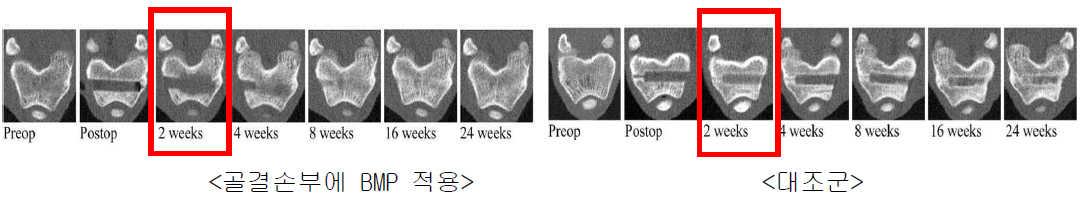 대퇴골 결손부에 BMP 적용 2주후에 초기 골흡수를 보이는 동물실험결과