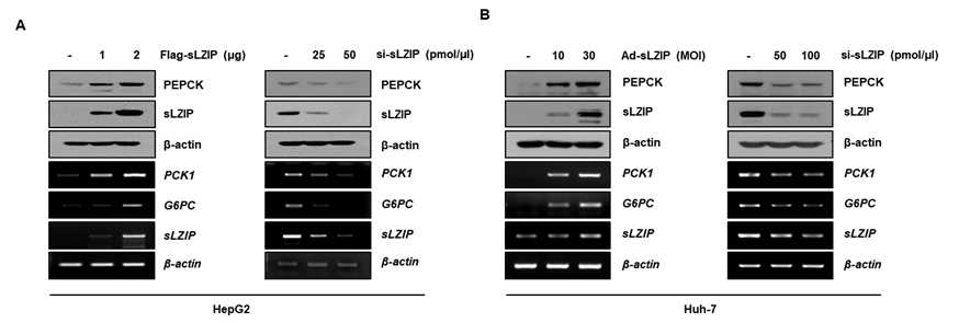 간 세포주에서 sLZIP에 의한 PEPCK 및 G6Pase mRNA와 단백질 발현 조절