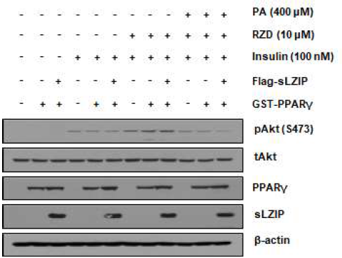 인슐린 저항성 증가 상태에서 인슐린 처리에 따른 PPARγ와 sLZIP의 관계성 조사
