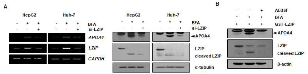 골지스트레스 하에서 LZIP N-말단 분리 조절에 따른 APOA4 발현 변화