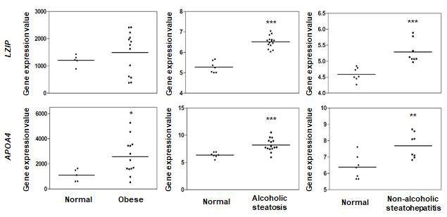 비만, 알콜성 지방간염, 비알콜성 지방간염에서 LZIP과 APOA4 발현 변화
