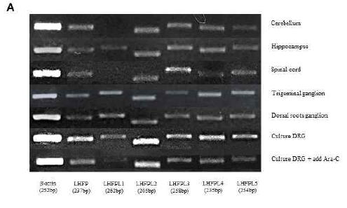 6주령 normal mouse의 신경조직에서 LHFPL 계열 6종의 발현을 RT-PCR을 통해서 확인 하였음. (A) Nornal mouse의 각 신경조직 (Cerebellum, Hippocampus, Spinal cord, Trigeminal ganglion, Dorsal roots ganglion) 에서 LHFPL1을 제외하고 나머지 LHFPL 5종 (LHFP, LHFPL2, LHFPL3, LHFPL4, LHFPL5)이 발현되는 것을 확인하였음. 또한 Dorsal roots ganglion (DRG)에서의 발현 양상에 있어 특히 LHFPL2, LHFPL3, LHFPL4가 비교적 높은 발현도를 보였음
