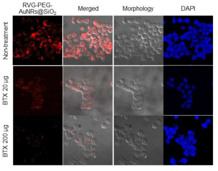 BTX (20 μg 및 200 μg) 또는 BTX없이 N2a 세포에 의한 RVG-PEG-AuNRs@SiO2 의 세포 내 흡수