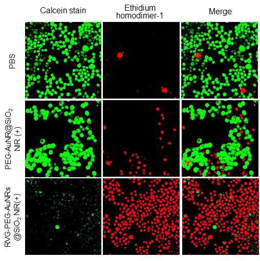RVG-PEG-AuNRs@SiO2, PEG-AuNRs@SiO2 및 PBS 완충액으로 처리 후 광열 치료한 N2a 세포의 Live/dead assay