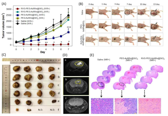 (A) RVG-PEG-AuNRs@SiO2, PEG-AuNRs@SiO2 또는 PBS 완충액으로 처리 후 광열 치료한 종양 유발된 마우스의 종양 크기 (B)RVG-PEG-AuNRs@SiO2, PEG-AuNRs@SiO2 또는 PBS 완충액으로 처리 후 광열 치료한 종양 유발된 마우스의 대표 사진 (C) RVG-PEG-AuNRs@SiO2, PEG-AuNRs@SiO2 또는 PBS 완충액으로 처리 후 광열 치료한 종양 유발된 마우스의 종양 사진 (D)RVG-PEG-AuNRs@SiO2, PEG-AuNRs@SiO2 또는 PBS 완충액으로 처리 후 광열 치료한 뇌종양 유발된 마우스의 MRI 데이터 (E) RVG-PEG-AuNRs@SiO2, PEG-AuNRs@SiO2 또는 PBS 완충액으로 처리 후 광열 치료한 뇌종양 유발된 마우스의 H&E staining