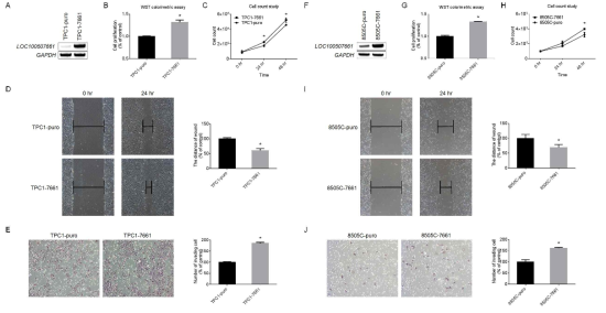 A-E. TPC1 세포주에서 LOC100507661 과발현 실험, F-J. 8505C 세포주에서 LOC100507661 과발현 실험