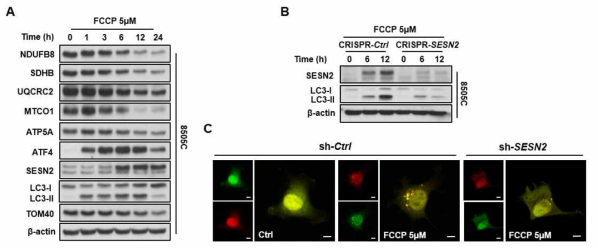 미토콘드리아 스트레스 시 Sestrin2에 의한 mitophagy 활성화