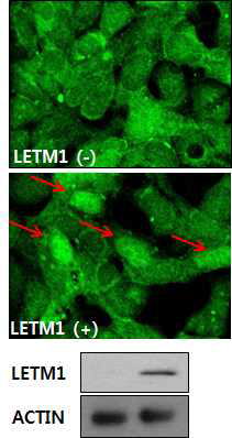 LETM1 과발현에 따른 YAP의 세포내 위치 변화