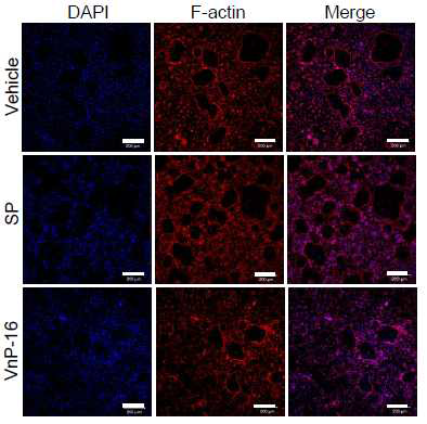 The effects of VnP-16 on F-actin-mediated cytoskeletal organi-zation in mature osteoclasts. The osteoclasts were cultured for 1 d on plates that were precoated with vehicle (DMSO), SP (9.1 μg/cm2), or VnP-16 (9.1 μg/cm2), in the presence of 30 ng/ml M-CSF and 100 ng/ml RANKL. The cells were immunostained with DAPI (blue) and rhodaminephalloidin( red). Scale bars, 200 μm