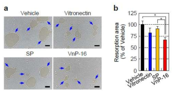 The effects of VnP-16 on bone resorbing activity in vitro. (a, b) The effects of VnP-16 on the bone resorbing activity of mature osteoclasts. Mature osteoclasts were cultured for 12 h on Osteo Assay Surface plates that were coated with vehicle (DMSO), vitronectin (0.23 μ g/cm2), or synthetic peptide (9.1μg/cm2), in the presence of 30 ng/ml M-CSF and 100 ng/ml RANKL. The cells were removed and the resorbed pits were photographed (a). The blue arrows indicate the resorption pits formed by osteoclasts. Scale bars, 200 μm. Bone resorption was assessed by pit area measurements (b). Data in b represents the mean ± s.d. (n = 5). *P < 0.01