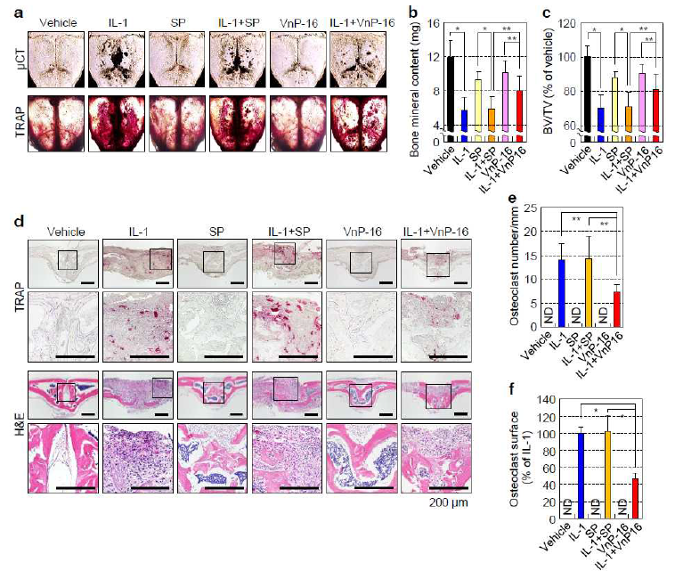 The effects of VnP-16 on IL-1-induced bone destruction in vivo. (a–c) The effects of VnP-16 on IL-1-induced bone destruction in vivo. A collagen sponge treated with vehicle (DMSO), IL-1 (2 μg), synthetic peptides (125 μg), or synthetic peptides (125 μg) plus IL-1 (2 μg) was implanted over the calvarial bone of 5-week-old ICR mice. TRAP staining and μCT imaging of whole calvariae were performed (a); the black spots indicate eroded surfaces. Bone mineral content (b) and BV/TV ratio (c) were measured by quantitative bone morphometric analysis. (d–f) Histological sections of calvarial bones were stained with hematoxylin and eosin (d, bottom) and histochemically for TRAP (d, top). The osteoclast number (e) and surface area (f) were determined by histomorphometric analysis. Data in b, c, e, and f represent the mean ± s.d. (n = 5). *P < 0.01 and **P < 0.05