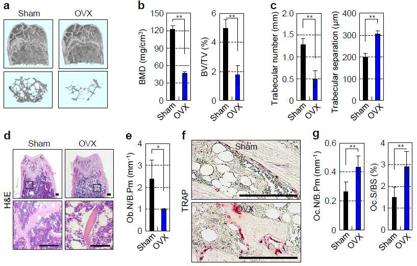 OVX mice exhibit severe trabecular bone loss in the femur. (a–c) μCT reconstruction of metaphyses of distal femurs (a), BMD and BV/TV (b), and trabecular number and separation in sham controls and OVX mice at 12 weeks after OVX. (d) H&E staining of femur sections from sham controls and OVX mice 12 weeks after OVX. Scale bars, 200 μm. (e) Morphometric analysis of osteoblast number in sham controls and OVX mice 12 weeks after OVX. (f) TRAP staining of femur sections from mice after OVX or sham operation. (g) Morphometric analysis of the osteoclast number and osteoclast surface in mice after OVX or sham operation. BS, bone surface. Scale bars, 200 μm. *P < 0.05, **P < 0.01