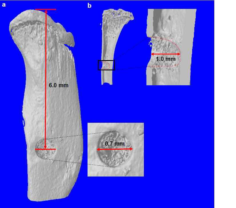 Burr-hole defect in the proximal mouse tibia. (a) Micro-computed tomography (microCT) image rendered to show the medial aspect of the tibia (oriented longitudinally) just after surgery. The red line drawn on the tibia measures the distance from the proximal end of the tibia to the centroid of the burr hole. Inset in the right is the magnified image of the circle indicated. (b) MicroCT image of a section along the frontal plane of the fractured tibia immediately after surgery. Inset in the right is the magnified image of the rectangle indicated. The red line drawn measures the depth of the burr hole