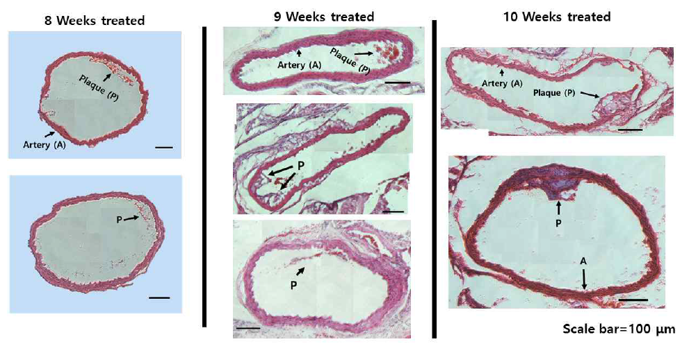 H&E staining을 이용한 각각 다른 고콜레스테롤 먹이 처리 기간에 따른 ApoE KO mice의 혈관 내 플라그 형성 정도 비교 결과