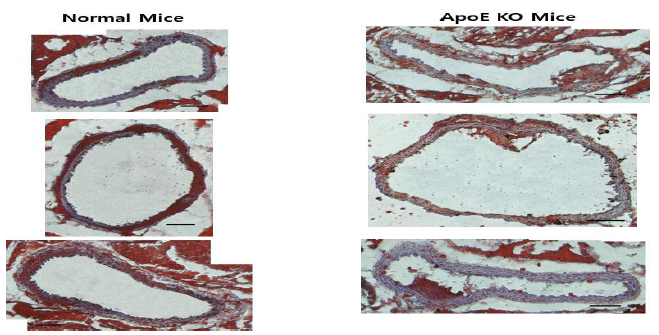 Oil red O staining을 이용한 10주간 고콜레스테롤 먹이 처리 후, 일반 C57BL/6 mice와 ApoE KO mice의 혈관 내 플라그 형성 정도 비교 결과 (Scale bar= 100 μm)