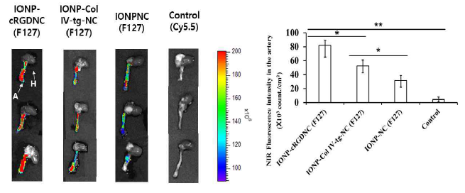 Iron oxide nanoparticle (IONP)를 도입한 F127 기반의 키토산 나노입자 및 리간드가 도입된 나노입자의 정맥 주입 24시간 뒤 플라그 형성된 혈관의 근적외선 이미지 및 그의 정량분석 결과 (p<0.05 is *, p<0.01 is **)