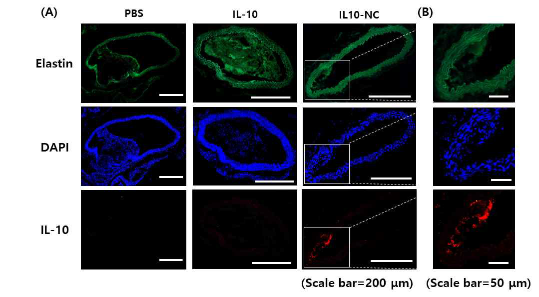 샘플 정맥주입 처리 후 면역염색을 통한 IL-10 약물 잔존 여부 확인 결과