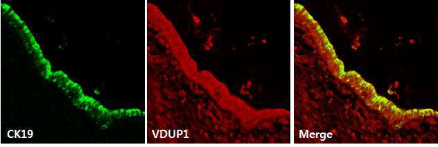 분화 및 증식하는 마우스의 간내 줄기세포에서 VDUP1의 감소