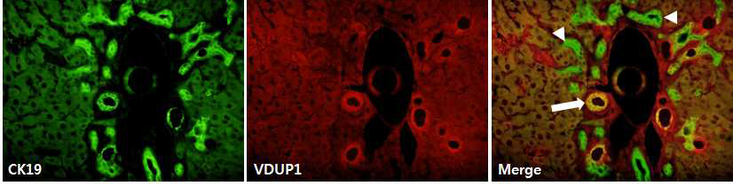 분화 및 증식하는 마우스의 간내 줄기세포에서 VDUP1의 감소