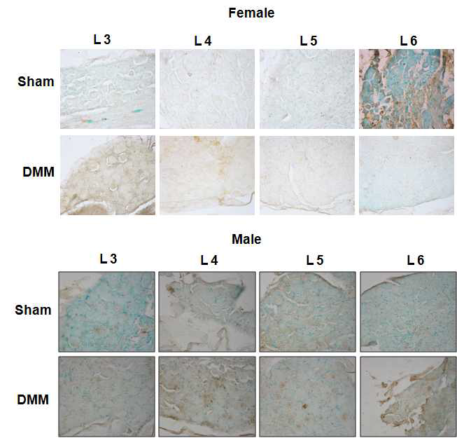 암수 마우스의 DMM 수술 후 lumbar 3-6에서의 TRPV1 수용체의 발현 확인