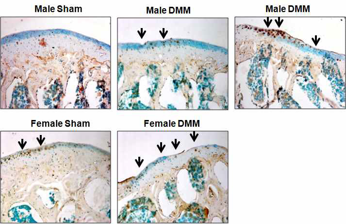 암수 마우스의 DMM 수술 후 연골 조직에서 MMP13의 발현 확인