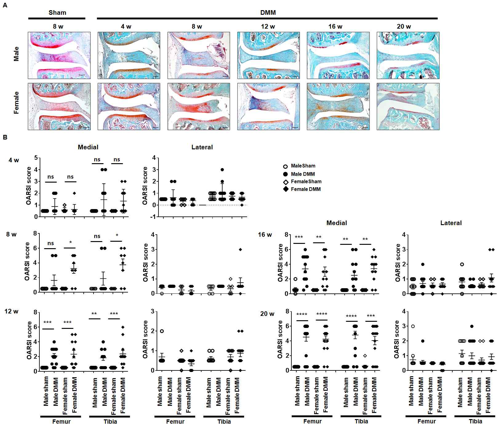 암수 골관절염 모델에서 joint cartilage의 손상 비교. A) Histopathological analysis of joint cartilage. B) OA grade at the knee joints by OARSI grading system