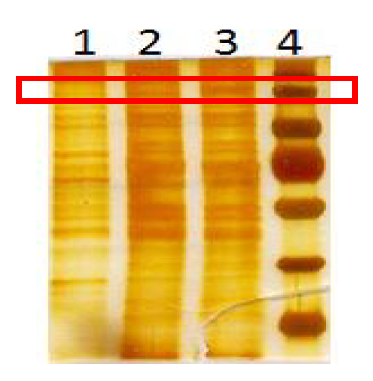 Expression and secretion of eS1-770-Fc recombinant protein. 1; Mock, 2; eS1-770-Fc1, 3;eS1-770-Fc4 4;Protein Marker