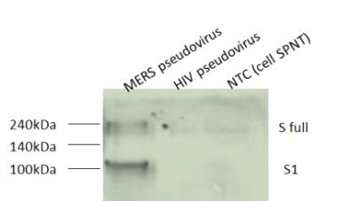 Using the Western Blot MERS-CoV psedovirus Spike gene expression