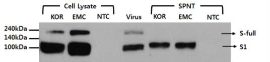 293T cell을 이용하여 제작한 pseudotype virus 발현 확인