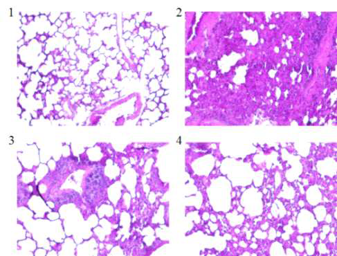 공격접종 5일 후 적출한 Lung Hematoxylin and Eosin-stain. 1; Non-treat 그룹, 2; 항원 접종없이 MERS-CoV 공격접종 그룹, 3; ESm770-His 1 ug만 어쥬번트 없이 2회 접종 그룹, 4; ESm770-His 1 ug과 Alum 어쥬번트 혼합하여 2회 접종 그룹