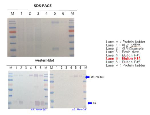 Affinity chromatography 결과 단백질 분석