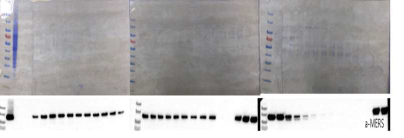 정제한 MERS-CoV eS770-TEV-His 항원의 SDS-PAGE 및 단백질 분석