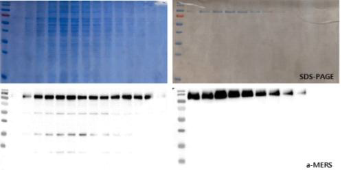 정제한 MERS-CoV eSm770-His 항원의 SDS-PAGE 및 단백질 분석