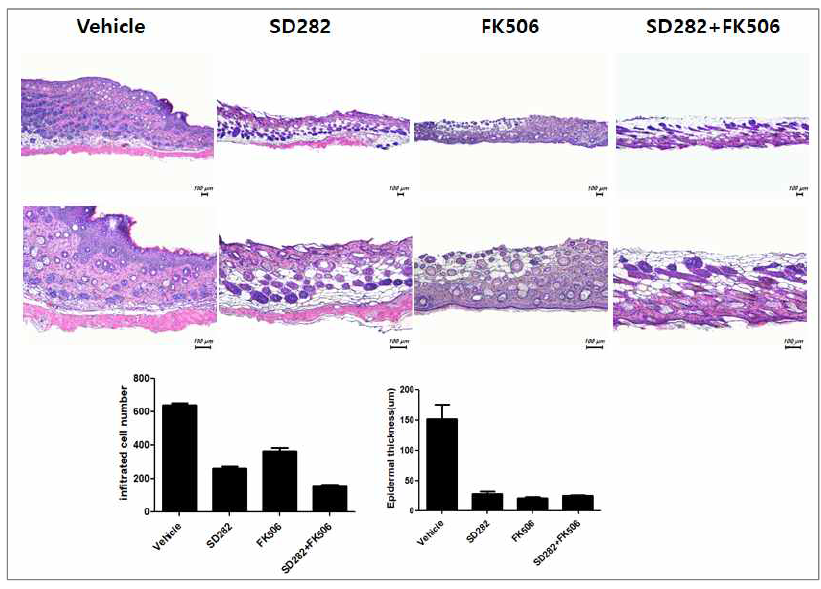 피부이식 모델 내 SD282와 FK506병용에 의한 이식편 염증성 세포 침윤억제
