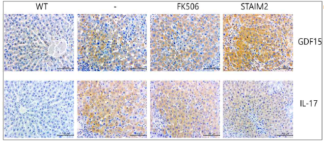 간이식 동물 모델 내 STAIM 2에 의한 GDF-15증가 확인