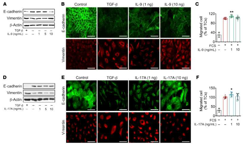 Stimulation with IL-9 and IL-17 results in an EMT-like phenotype in human tumor cells