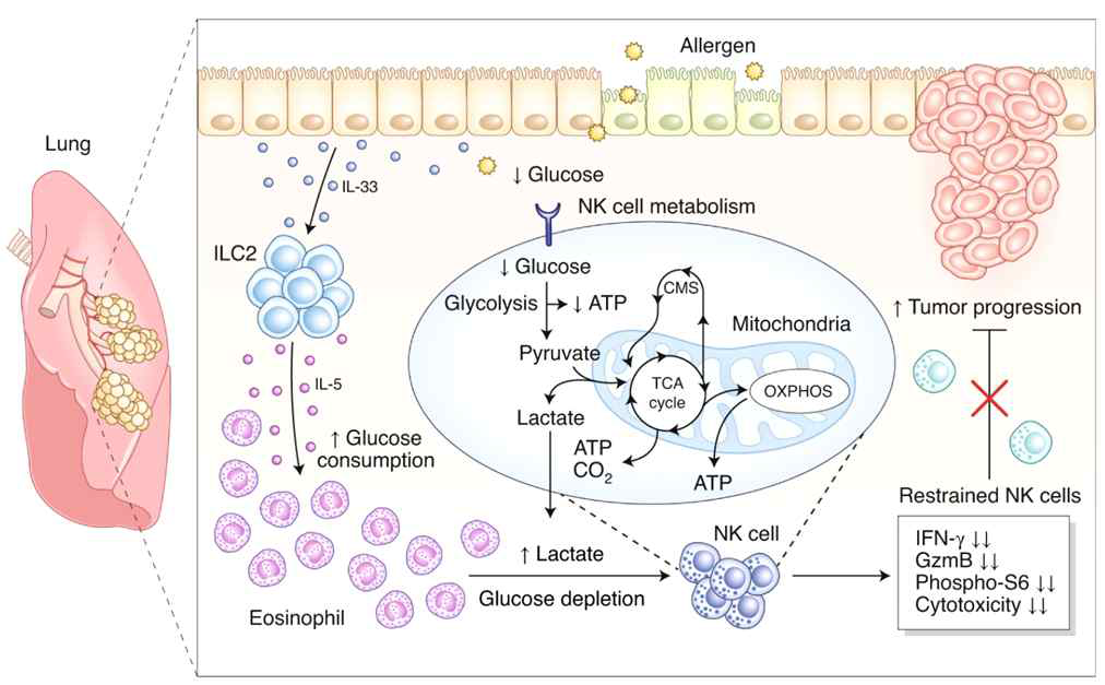 Type 2 immune response로 인한 폐암 전이의 확산에 대한 작용기전