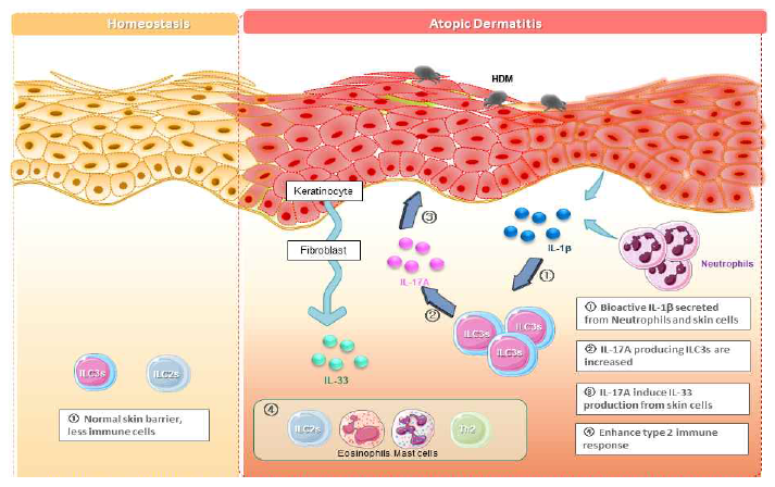 아토피의 병인기전으로서 선천성림프구 세포의 이해