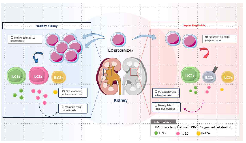 신장의 항상성 유지를 위한 선천성림프구의 역할: 신장 염증상황에서 PD-1을 통한 억제신호를 통해 ILCs의 기능이 감소되어 염증이 악화됨