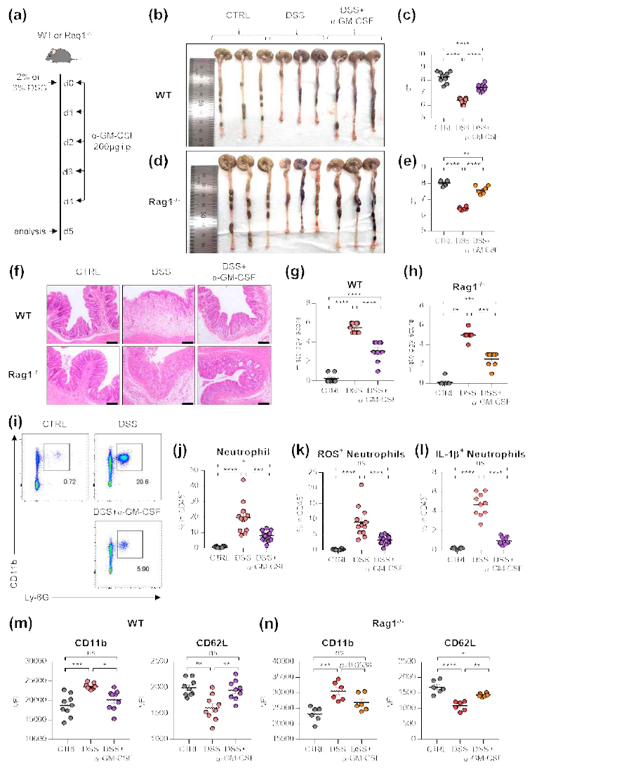 IBD 동물모델에서 GM-CSF neutralization의 치료효과