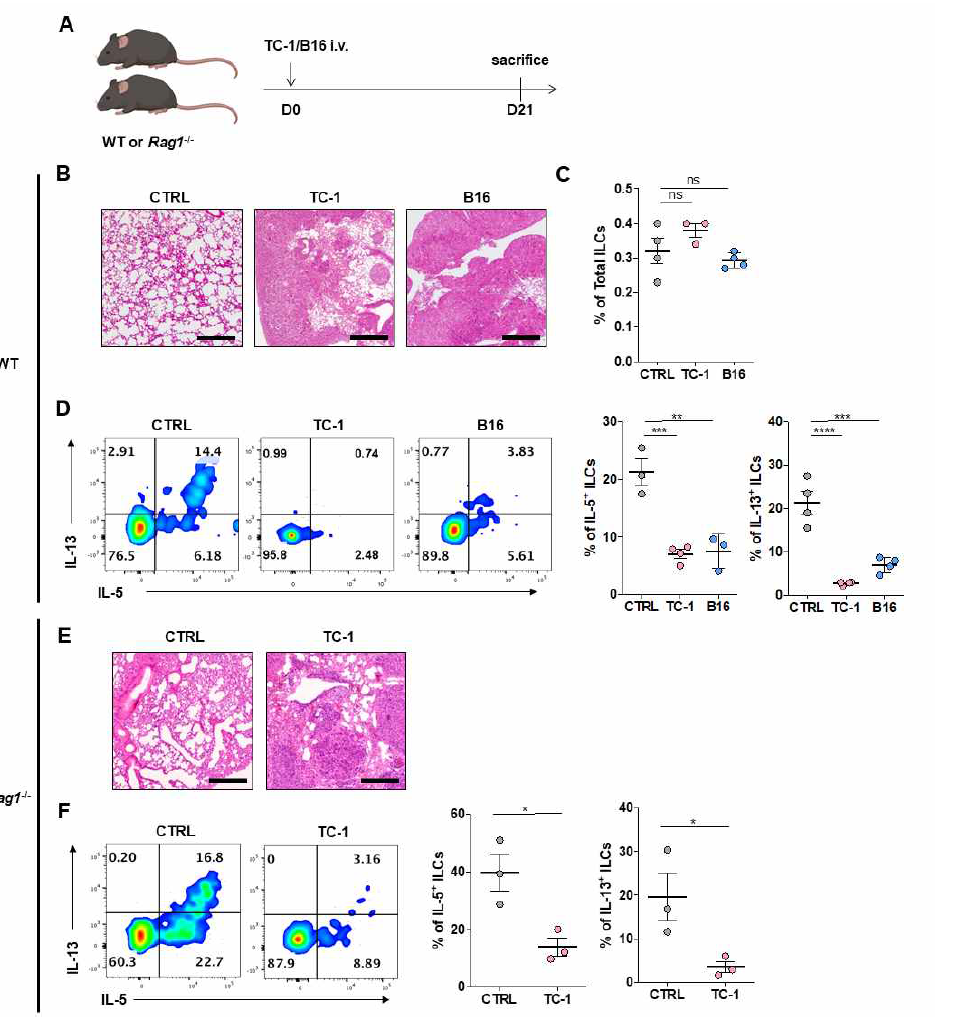 Lung cancer 상황에서 ILC2s의 분포 변화