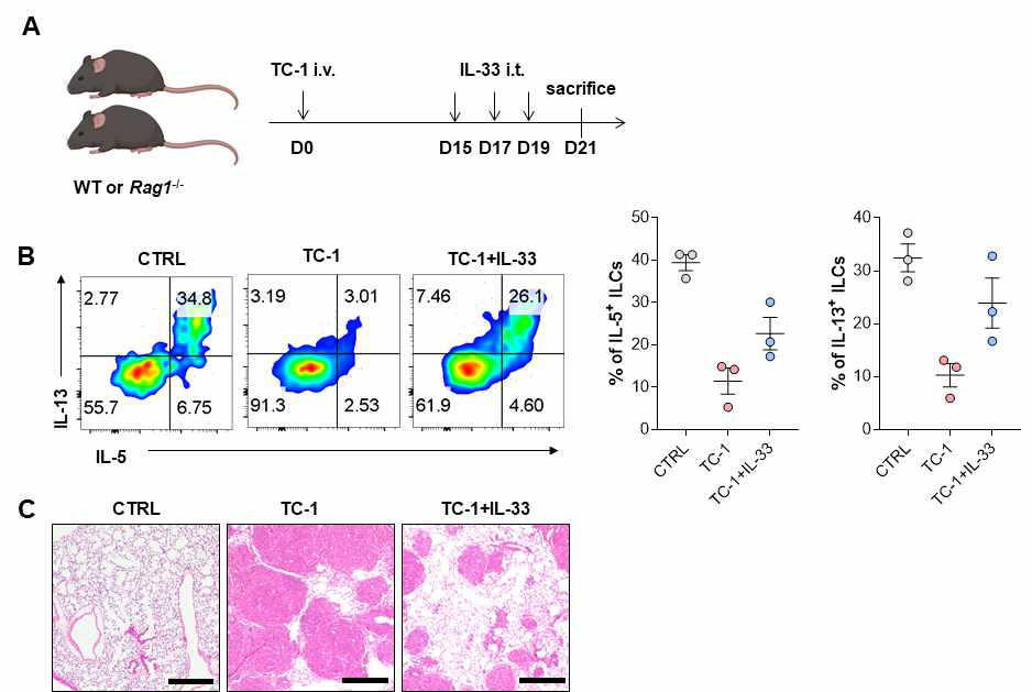 ILC2s를 활성화 시켰을 때 tumor progression의 변화 확인