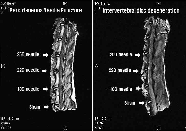 손상유도 방법 및 defect size에 따른 추간판 손상유무 MRI 검증결과