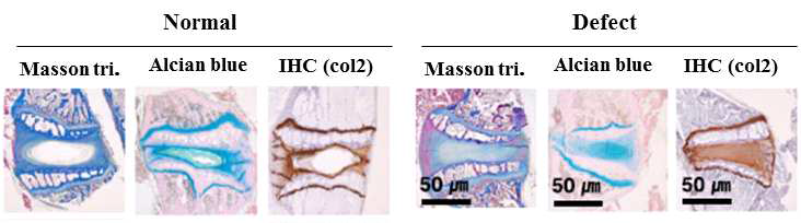 조직학적 분석을 통한 퇴행성 추간판 재생 효능 검증