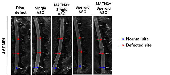 토끼 디스크 재생효과 확인을 위한 4.5T MRI 영상분석 결과