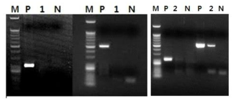 Agarose gel electrophoresis of PCR products, using primers for Coxiella burnetii IS1111a gene. M, 50-bp DNA ladder as a size marker; P, C. burnetii DNA control (band represents expected 202-bp PCR product); 1, DNAs from patient with other febrile disease (left); 2, DNAs from patient with acute Q fever (right); N, negative control
